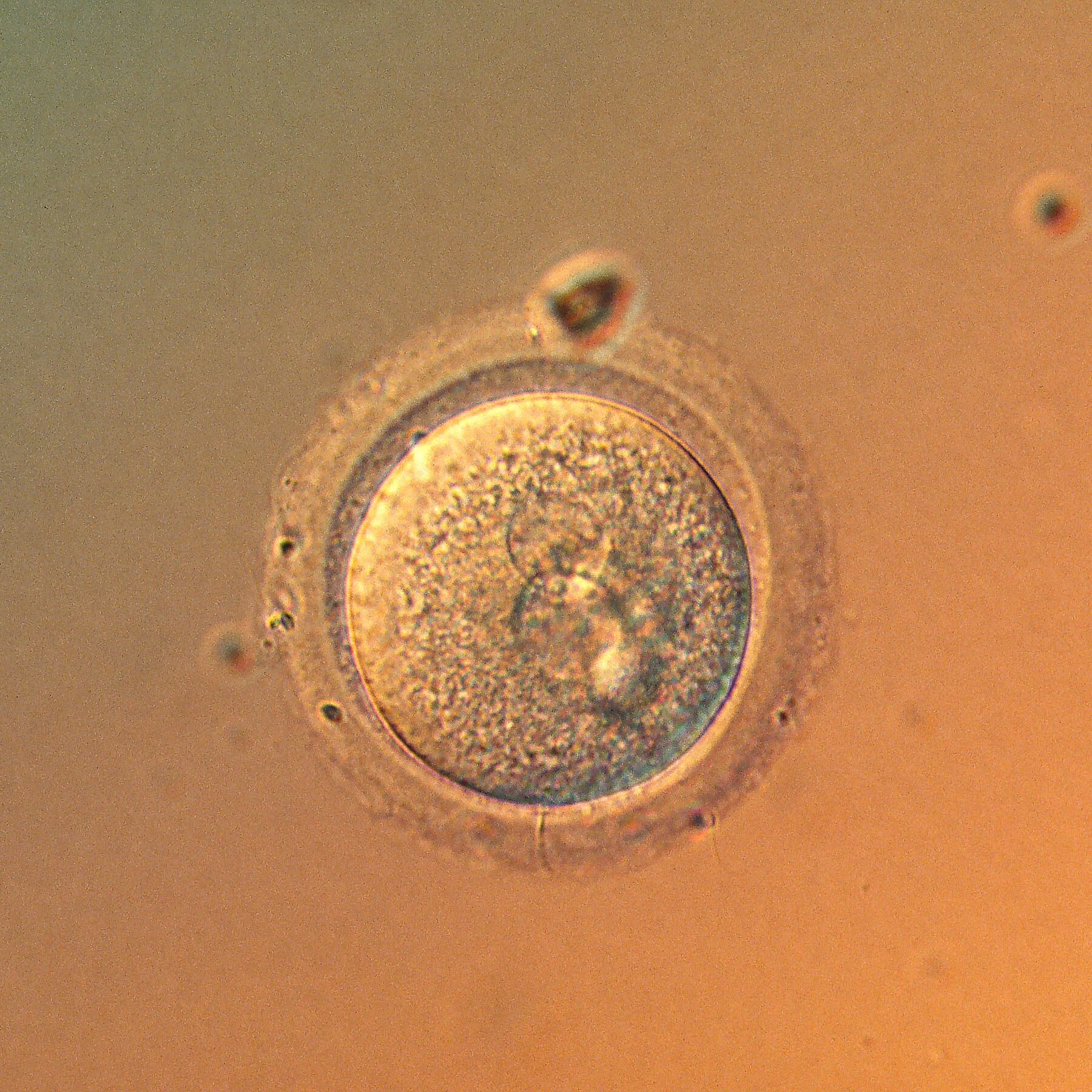 In a First, Scientists Precisely Edit Human Embryo Genes
