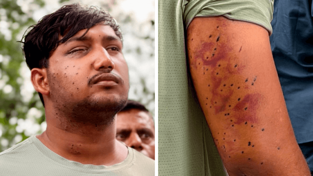 India's 'cockroach' protesters have wounds consistent with pellet-gun fire, say experts