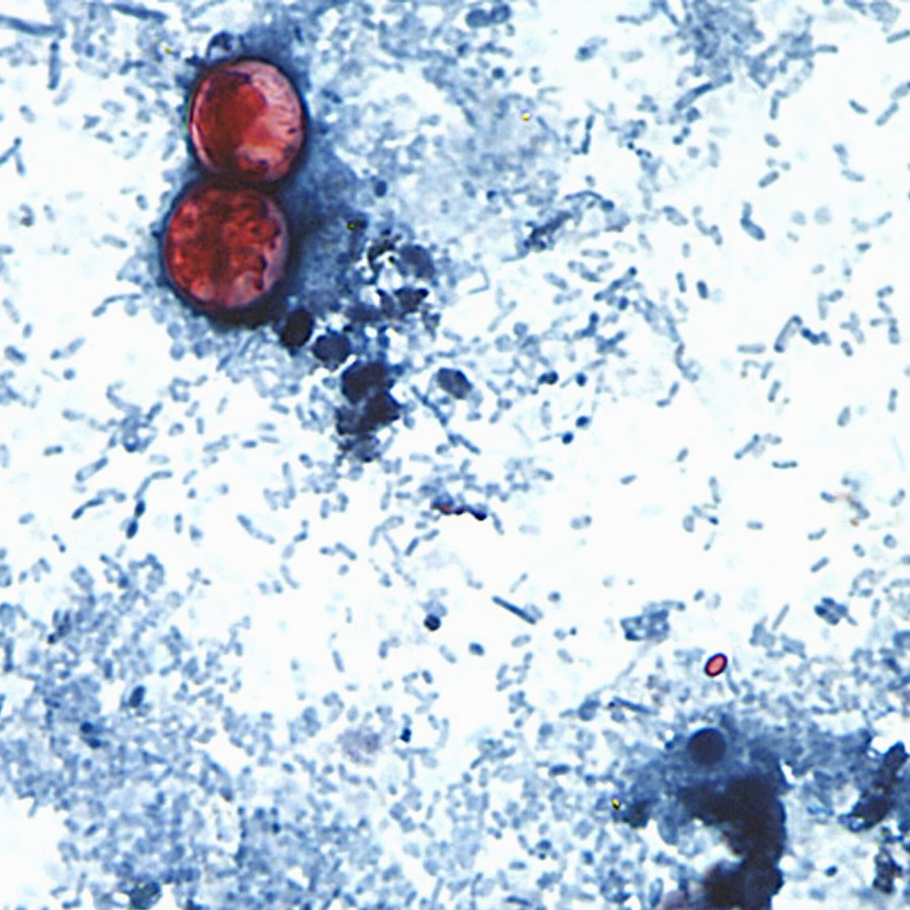 What the Cyclospora Outbreak Reveals