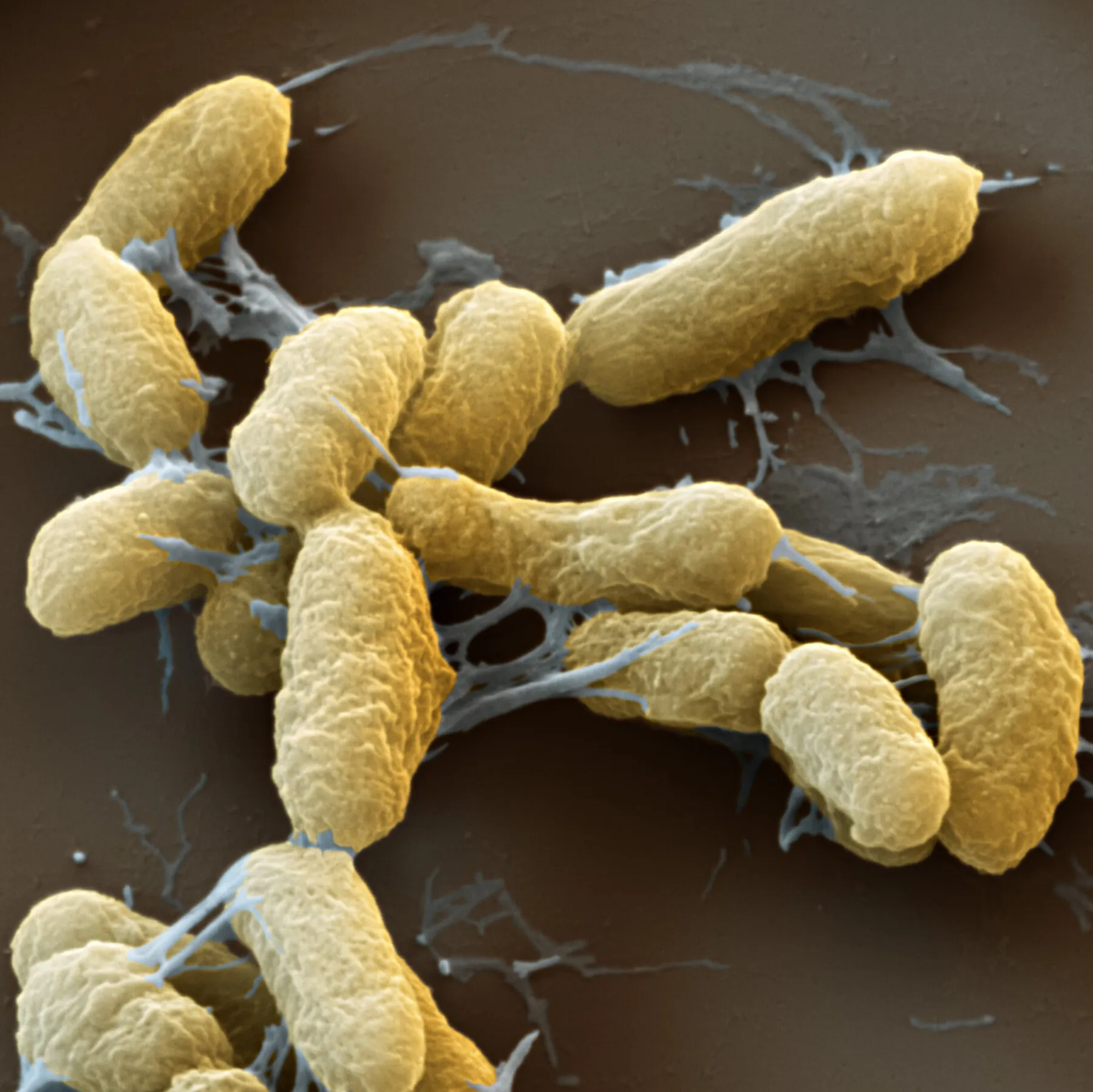 What Experts Want to Know About the Russia Plague Scare